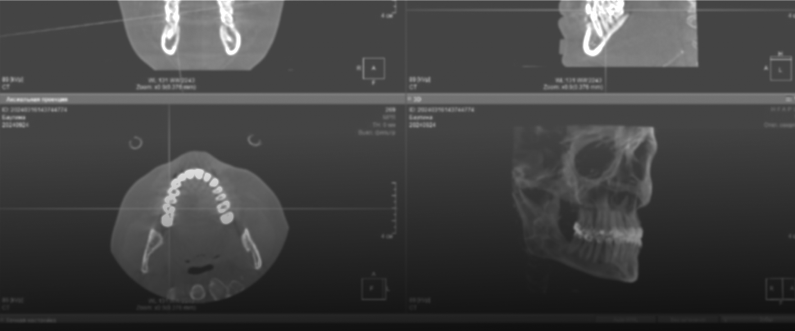 КЛКТ в подарок