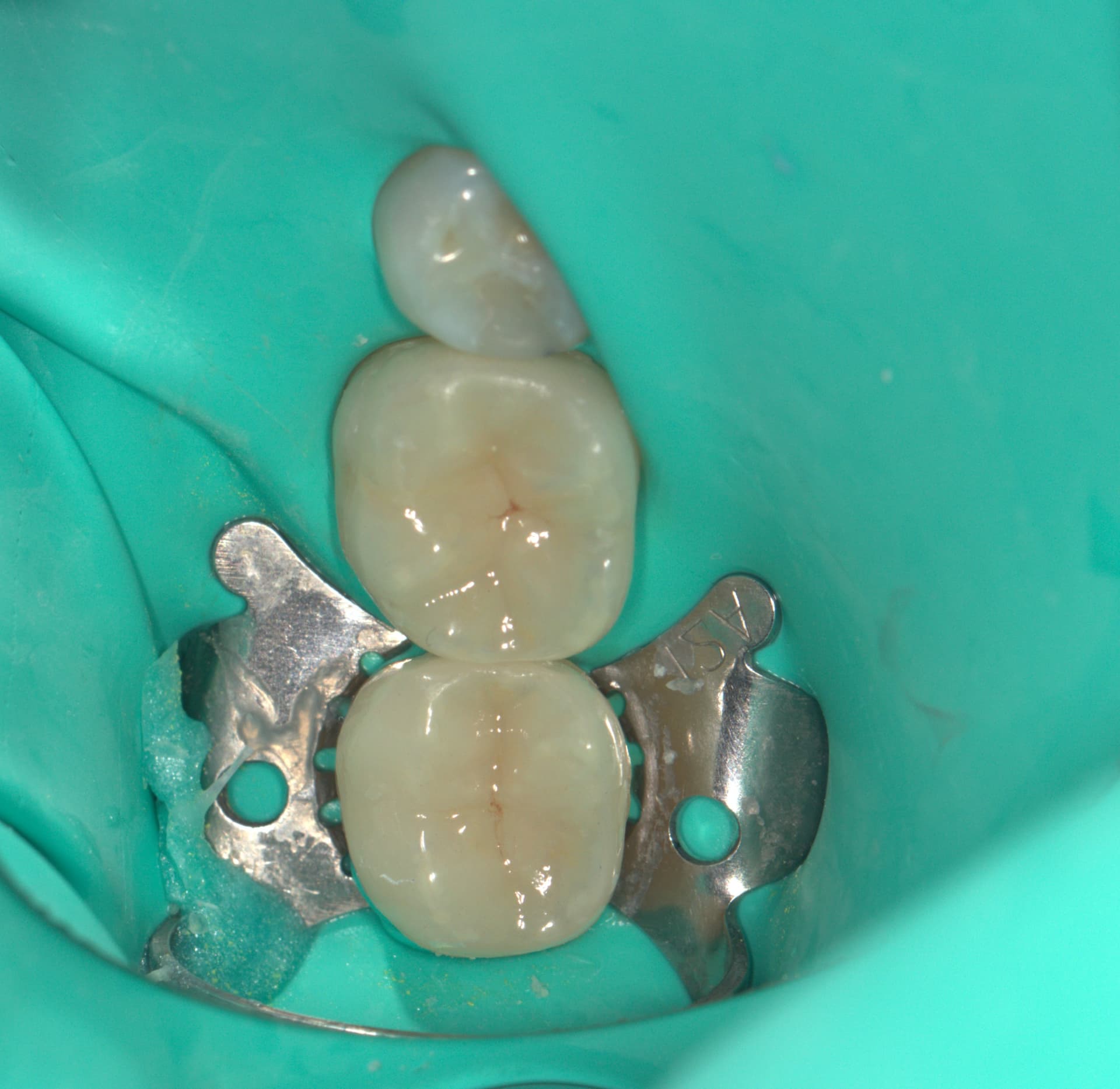 Конечный этап