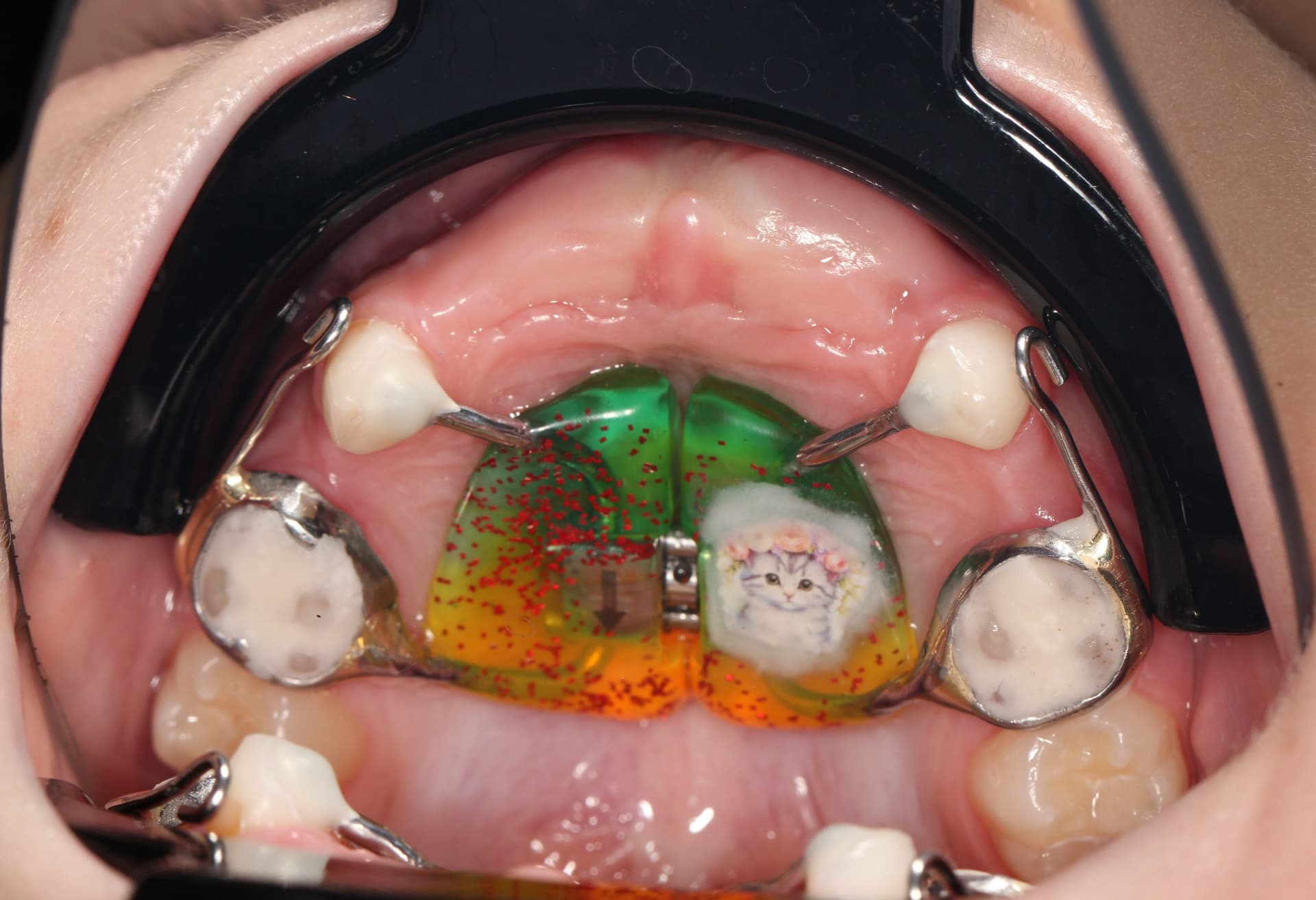 После установки 