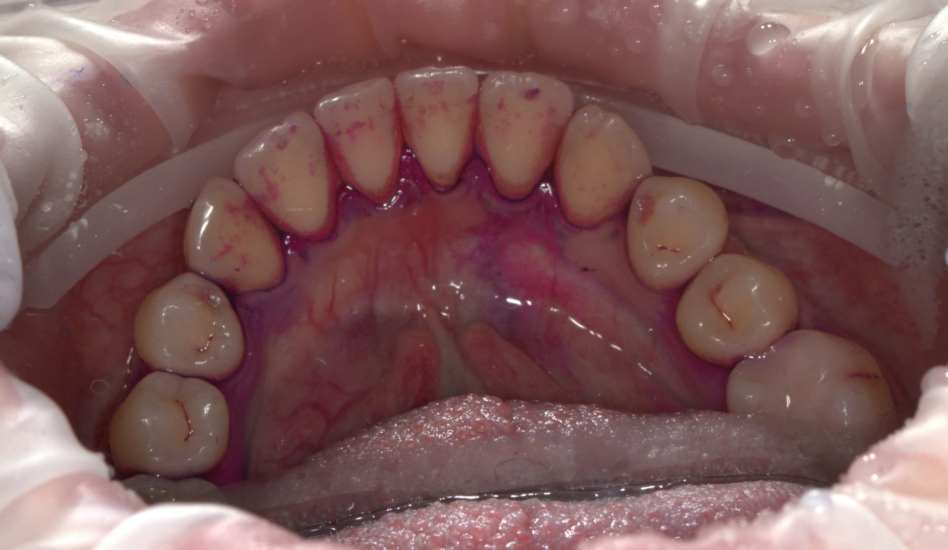 Окрашивание