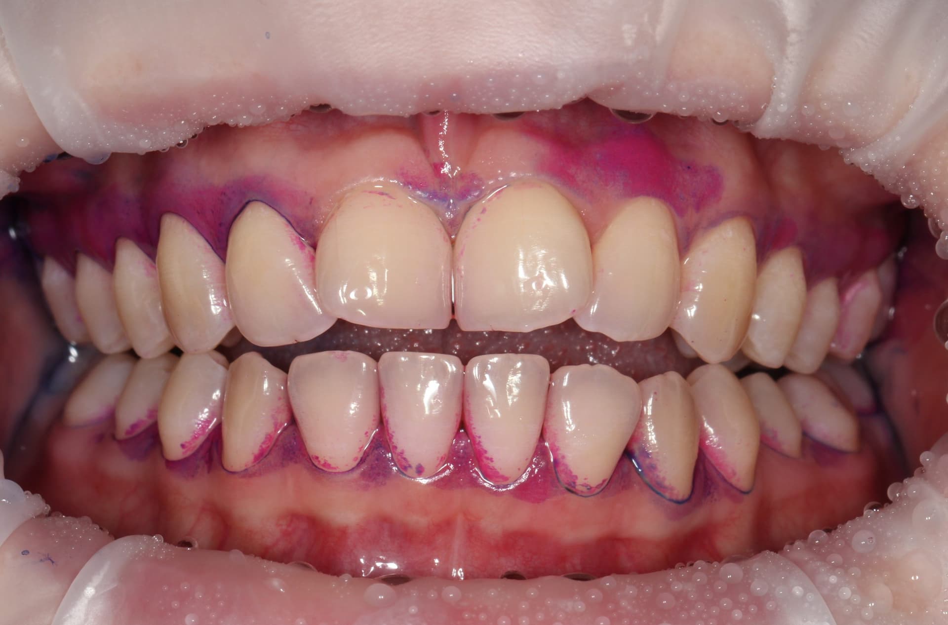 Окрашивание