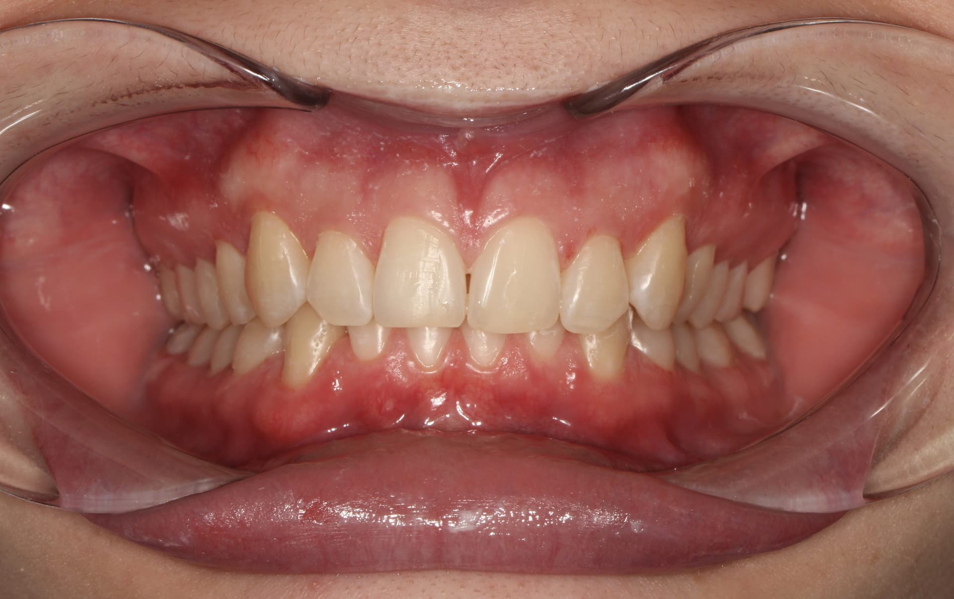 Динамика за 9 месяцев