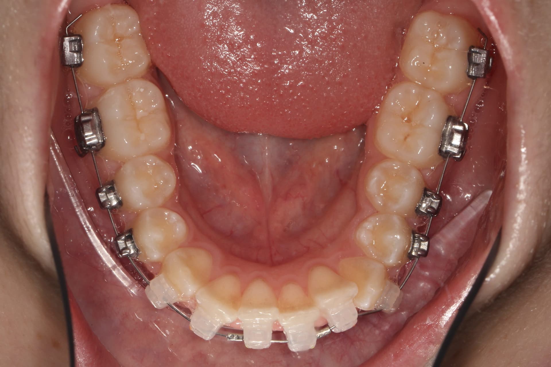 На этапе лечения